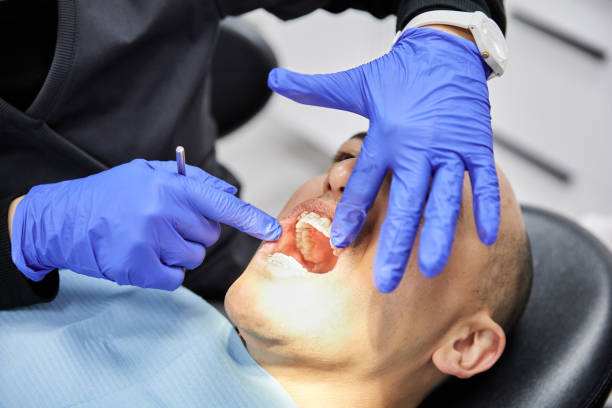 Best Emergency Wisdom Teeth Removal in Montclair, VA