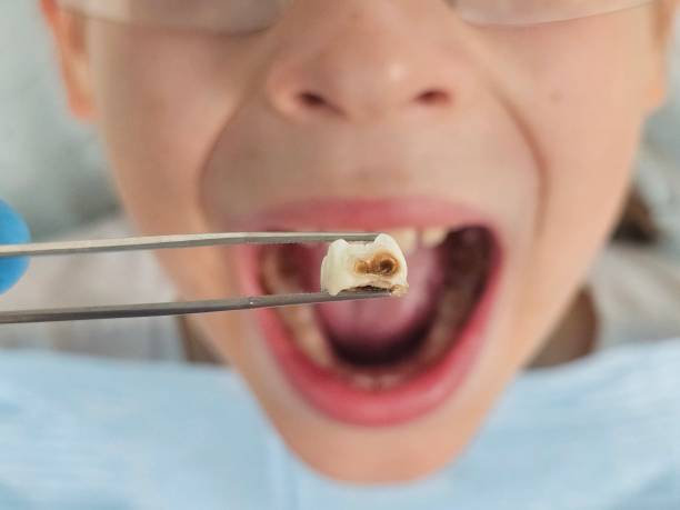 Best Emergency Root Canal Treatment in Montclair, VA